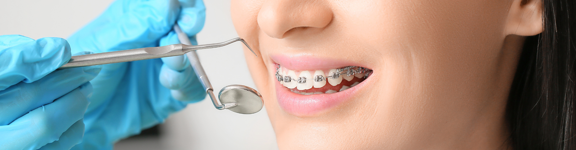 Gloved hands holding dental tools next to girl's mouth with braces.